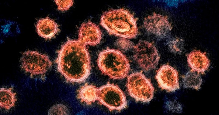 'FLiRT' new coronavirus subvariant predominant in Canada. What you need to know about this stock – National