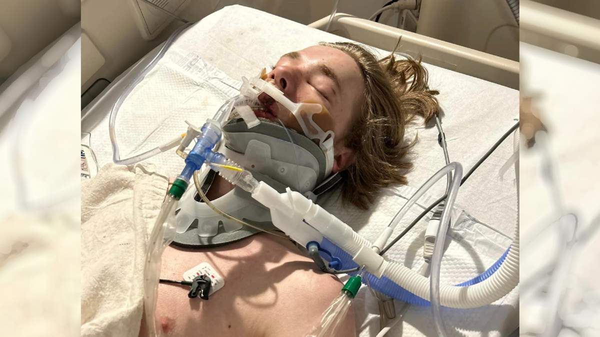 According to his father, 15-year-old Zander was given a 17 per cent chance of survival when he arrived in hospital on May 2 after spending a night in a central Alberta ditch following a dirt bike crash. (Photo courtesy: King family)