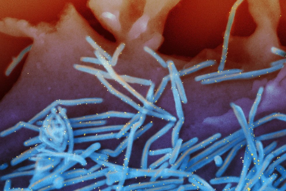 World's 1st RSV vaccine available for older Americans this fall: CDC - National - Vimarsana News