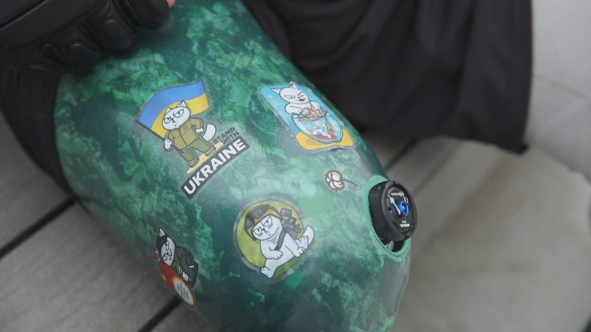 Stickers on a prosthetic leg are visible.