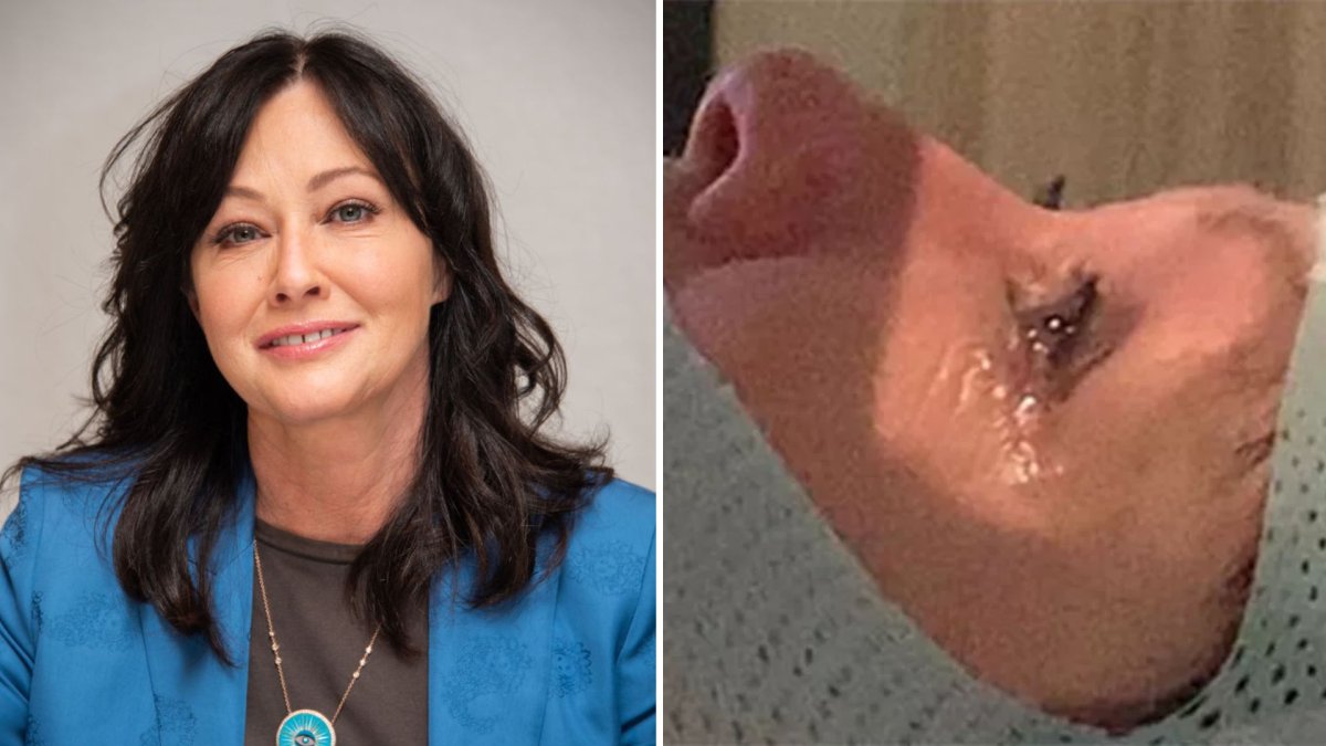 Shannen Doherty says breast cancer has spread to her brain: 'My fear is  obvious' 