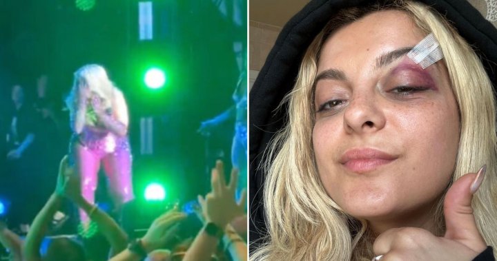 Bebe Rexha collapses after fan throws phone at her face, man arrested