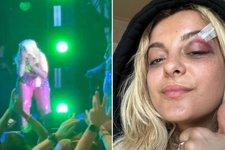 Bebe Rexha collapses after fan throws phone at her face, man arrested | 91.5 The Beat