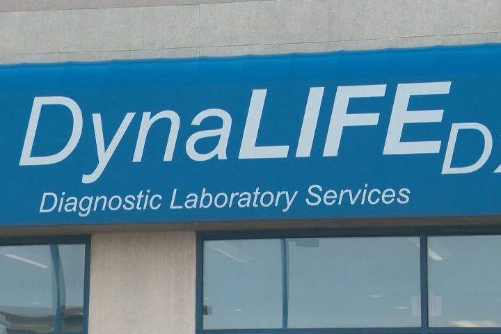 Alberta premier hints at ‘other arrangements’ as Dynalife struggles with lab services