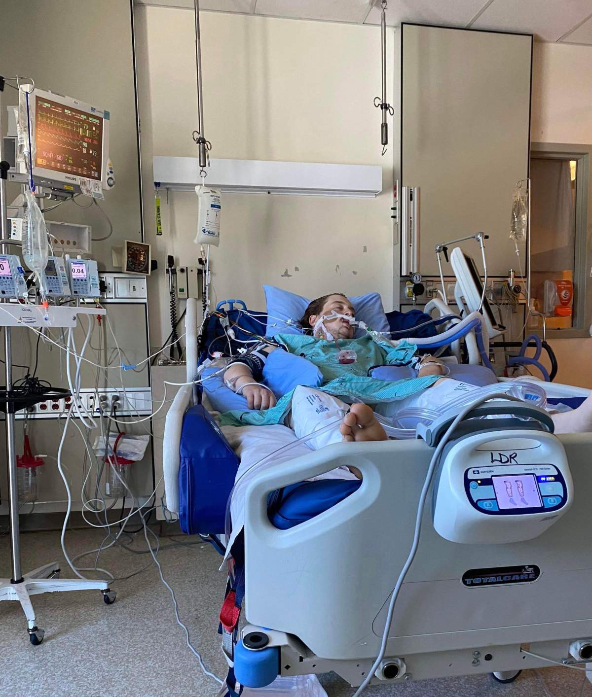 Colin Dube-Wheat in hospital after being stabbed in Campbell River on July 14.