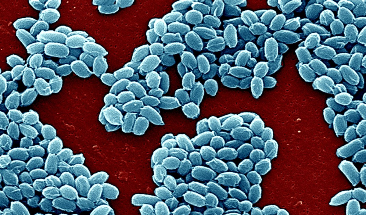 Anthrax bacterium spores, as seen through an electron microscope.