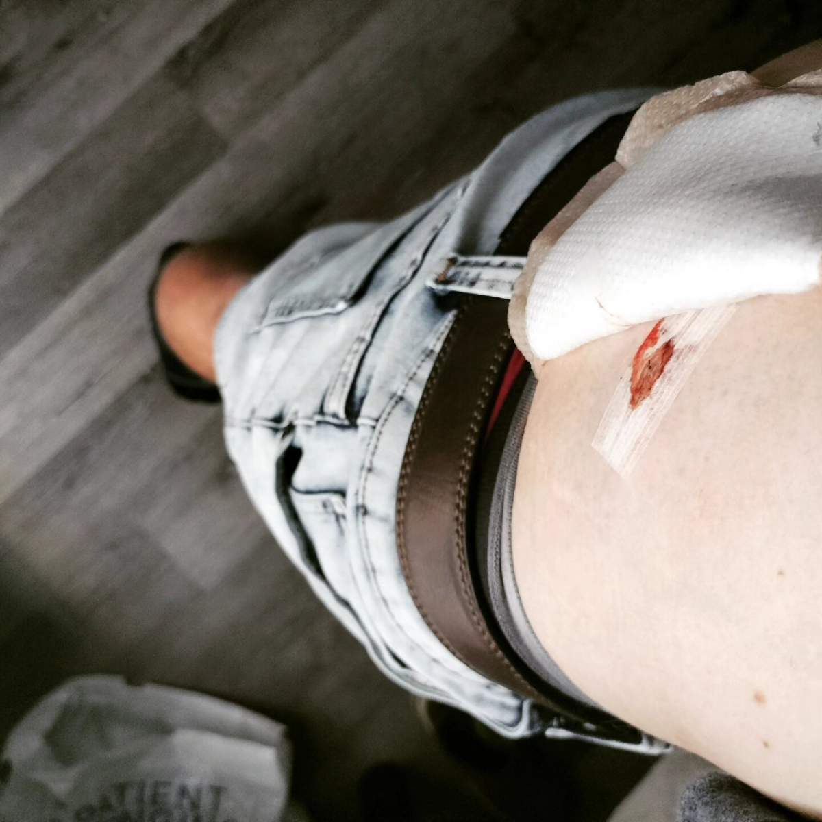 New Zealander Jamie Hallowes shows the stab wounds he sustained while vacationing in downtown Vancouver on Wed. July 12, 2023.