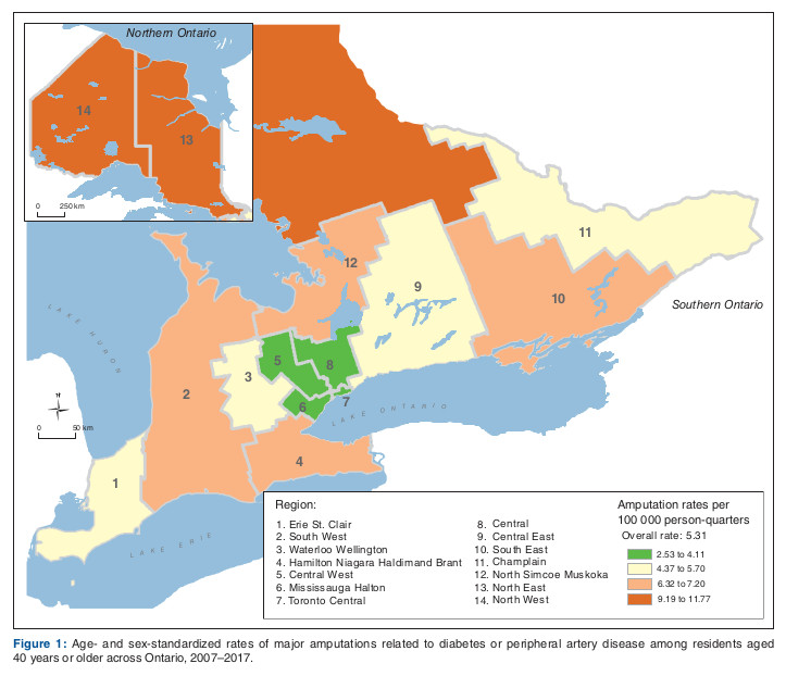 Age- and sex-standardized rates of minor or major amputations for diabetes or peripheral arterial disease across Ontario