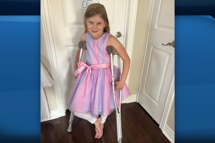 ‘No surgery date in sight’: Ontario child desperately needs help to stabilize leg