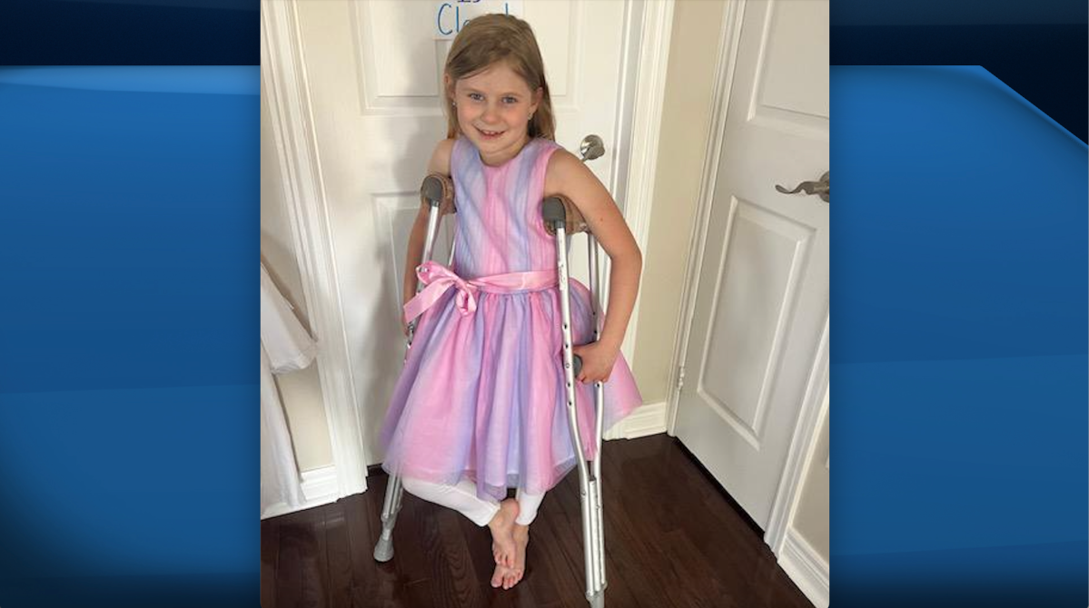 Grace Anstey, 9, has dislocated her knee six times in the last year and is in need of knee surgery that is proving to be hard to get.