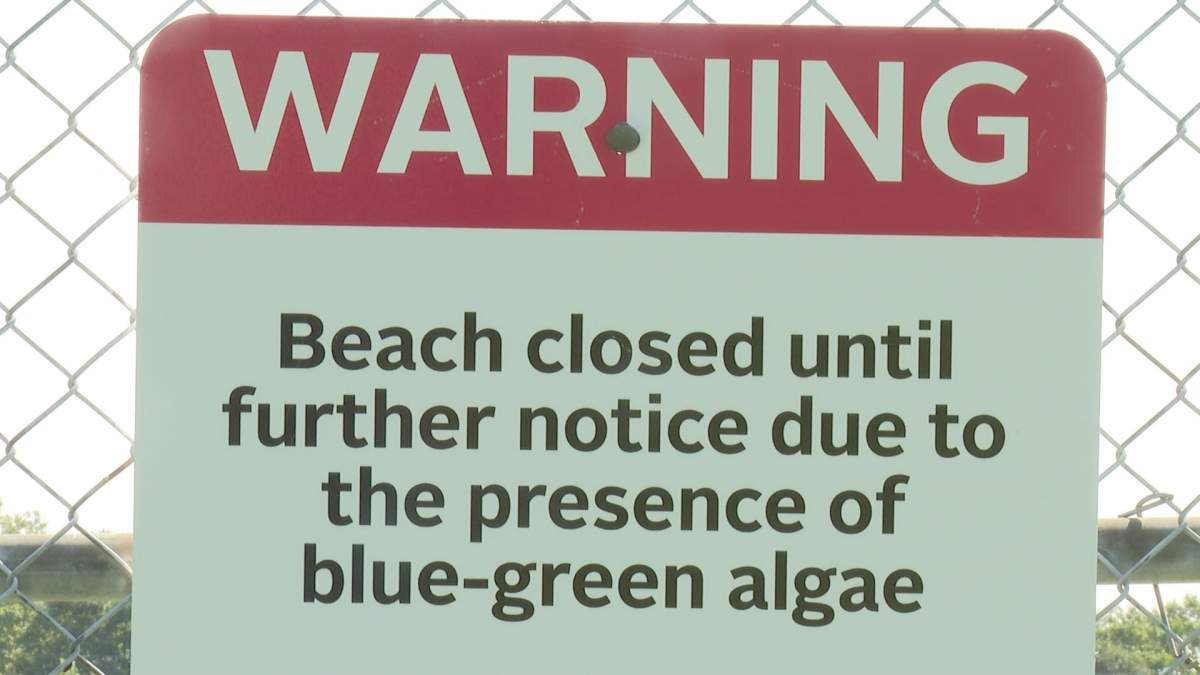 A warning sign at Cunard beach in Halifax, advising residents of the blue-green algae present.