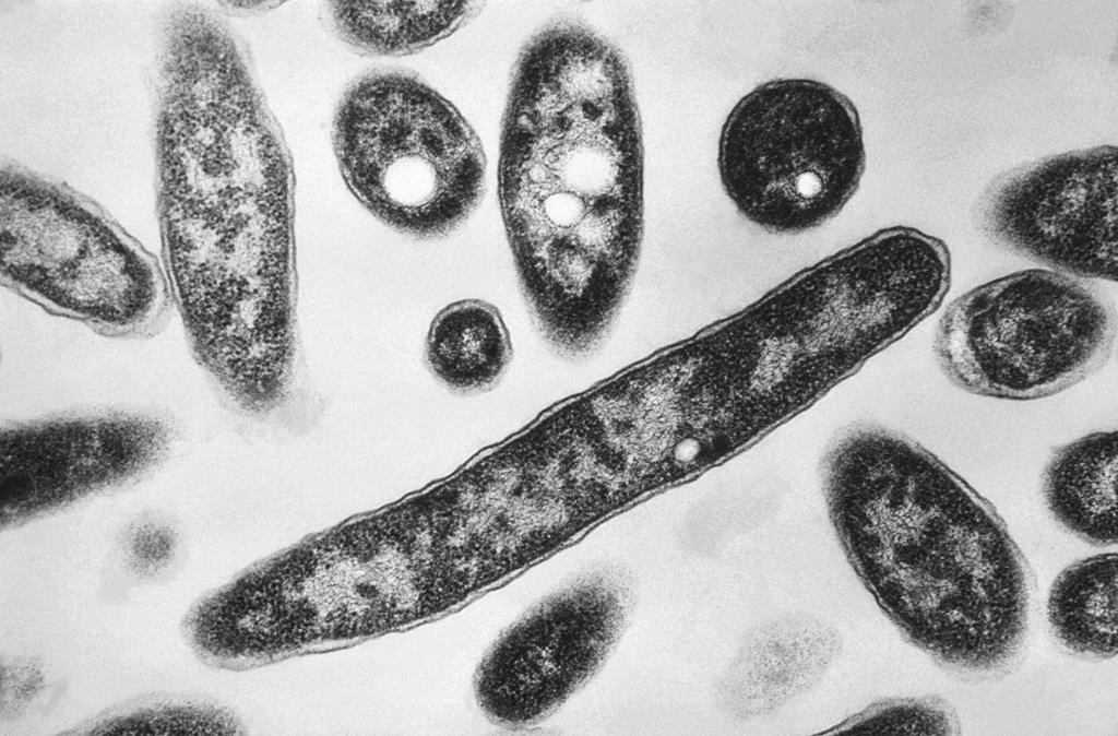 This 1978 electron microscope image made available by the Centers for Disease Control and Prevention shows Legionella pneumophila bacteria, which are responsible for causing the pneumonic disease legionnaires' disease.