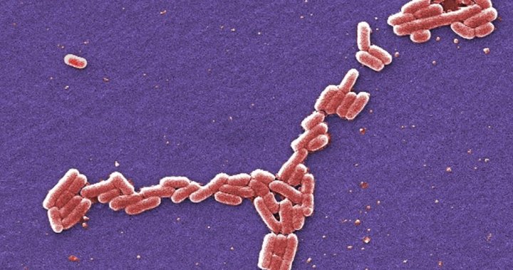 E. coli infection can act like ‘acid on the intestinal wall,’ expert says