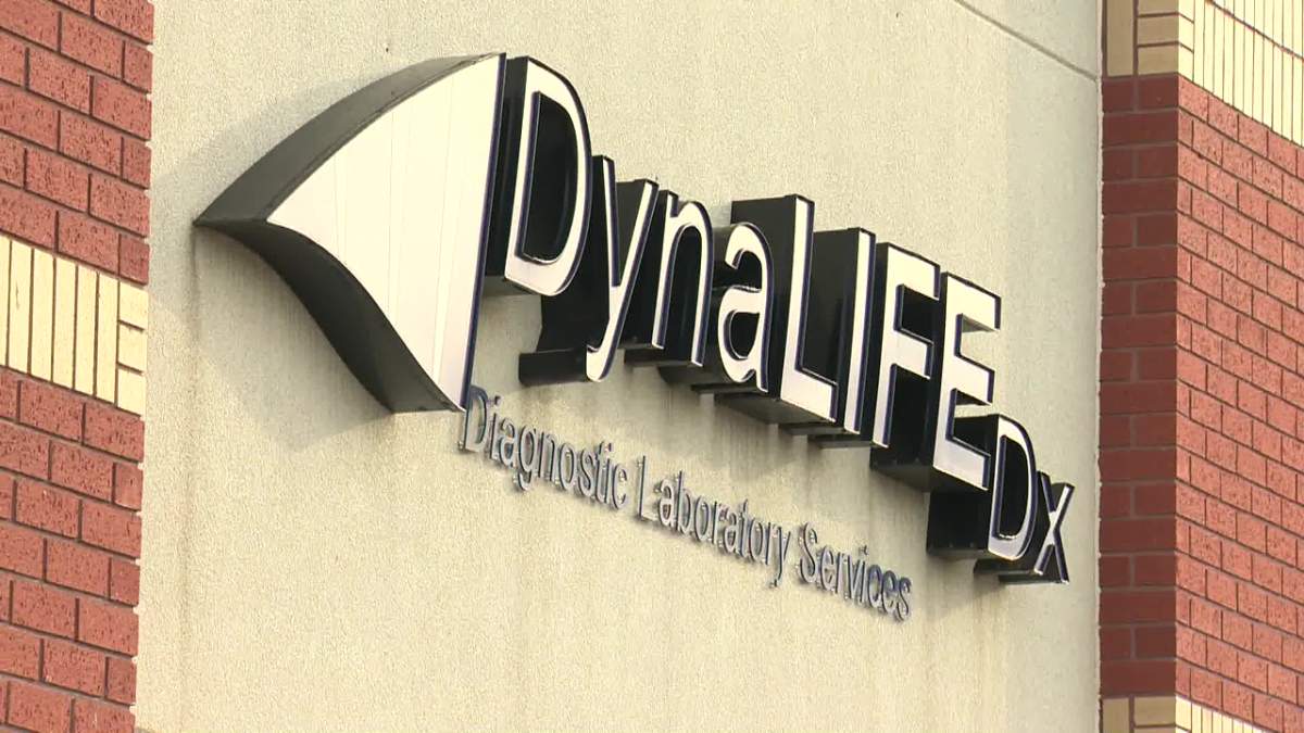 Critics point to the Alberta government's failed contract with Dynalife to provide blood and other lab tests as an example of what could go wrong under the UCP's new private health care plan.