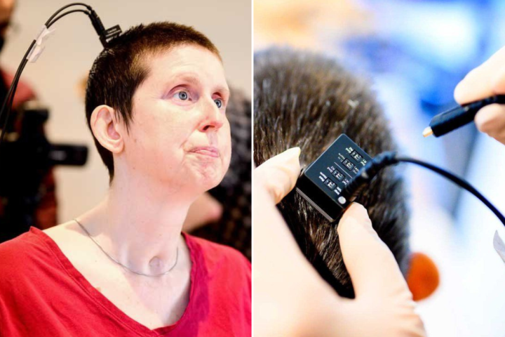 AI brain implant helps Sask. woman speak for the 1st time in 18 years - Vimarsana News