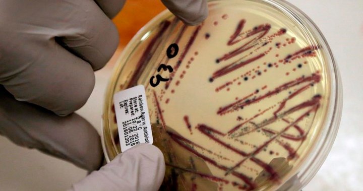 Ottawa ‘ready’ to help as Alberta daycare E.coli outbreak grows