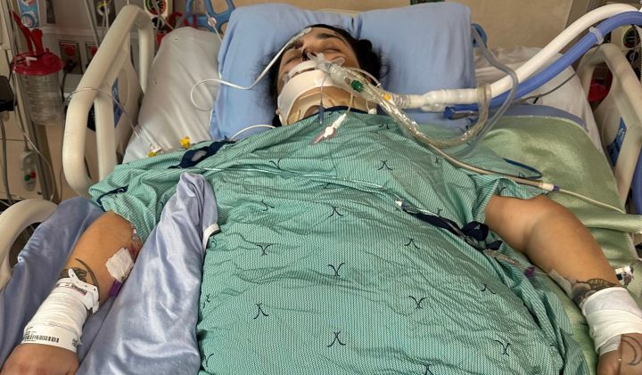 An Edmonton family says the 24-year-old woman who was injured in a ht and run in the area of 96 Street and 115 Avenue on Aug. 31, 2023 is Alexandra Bonilla.