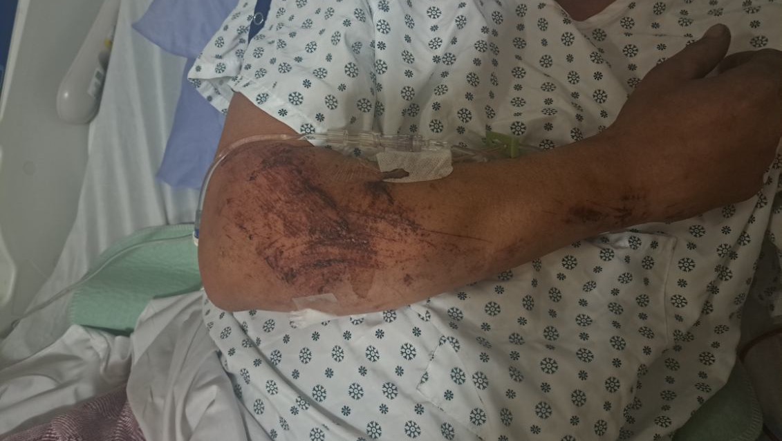 Alberta tow truck driver Cory Armstrong struck while working.