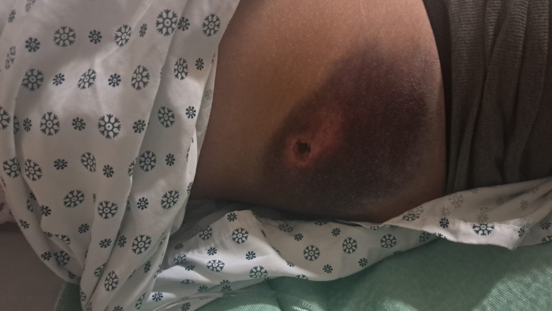 Alberta tow truck driver Cory Armstrong struck while working.