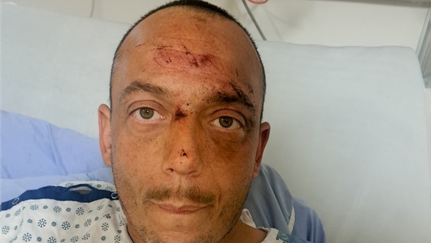 Alberta tow truck driver Cory Armstrong struck while working.