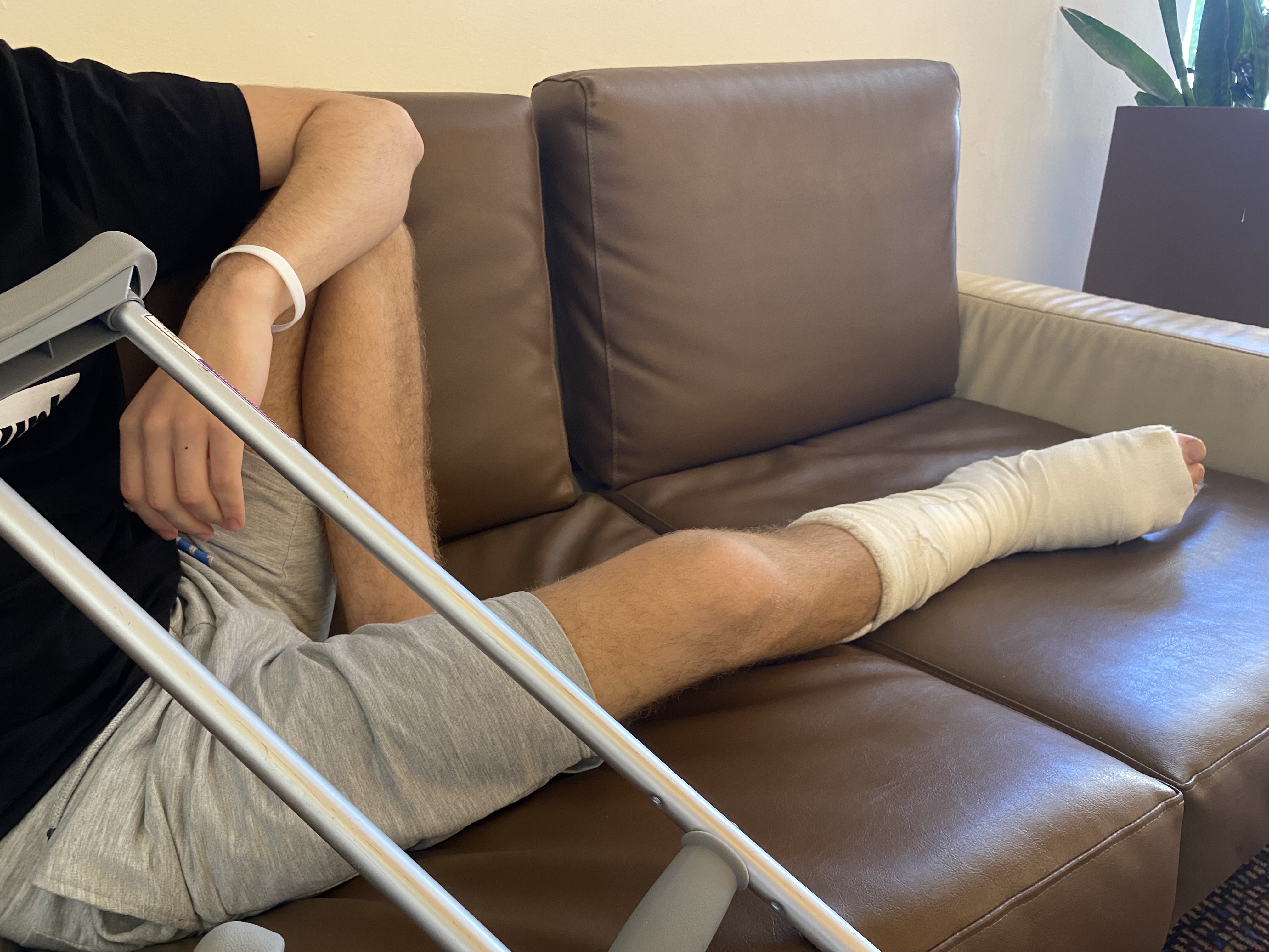 Eitam Messika, 15, who did not want his face to show, broke his foot jumping out of a window when Hamas set fire to his house on Oct. 7, 2023.