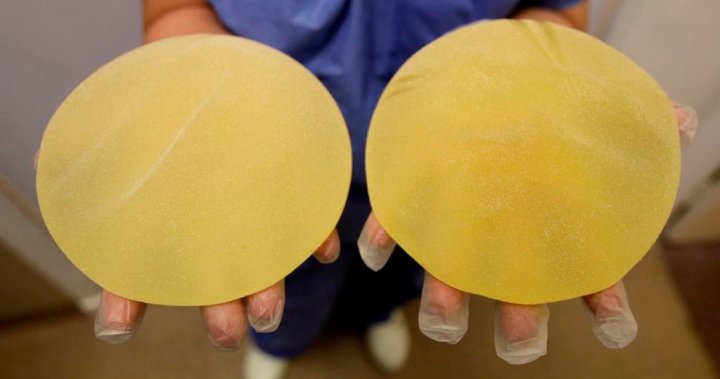 Create breast implant registry, health committee says in new report