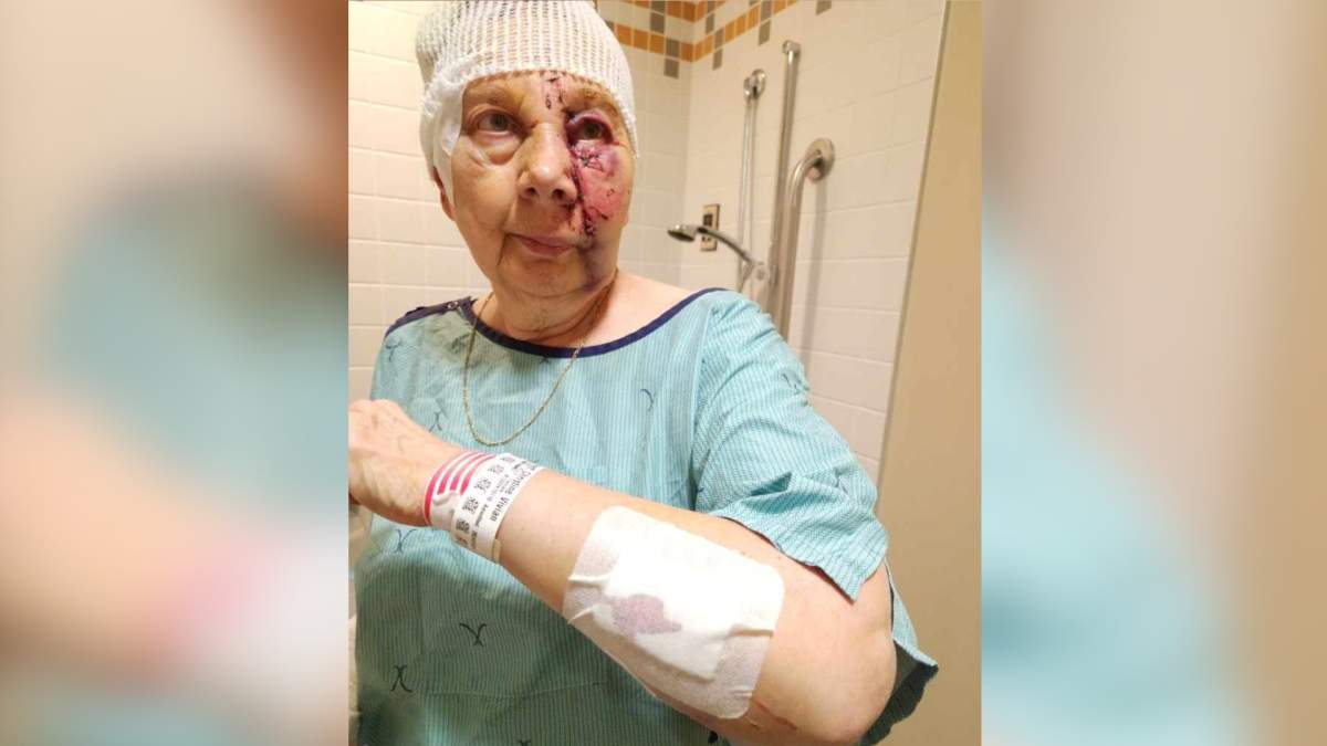 Norfolk County resident Chris Bonnett said she had no time to get away from a dog that would attack and send her to a hospital with serious injuries on Nov.1.