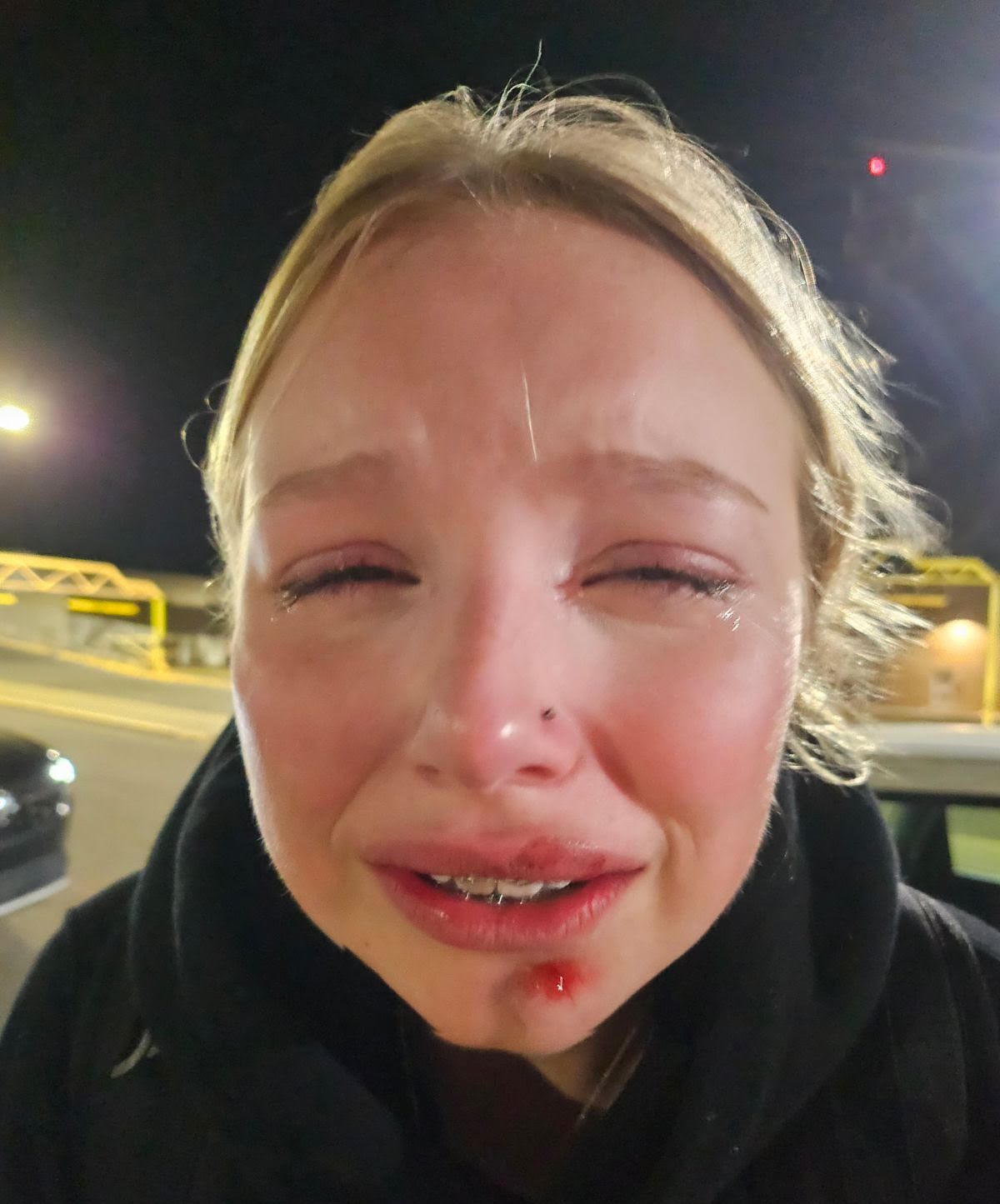 Haylie Nahamko-White was tackled during a case of mistaken identity with the Edmonton Police Service in north Edmonton on Monday, Nov. 13, 2023.