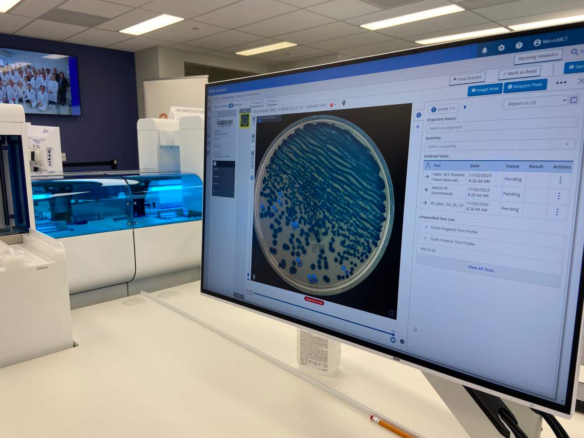 The high-resolution camera, in combination with BD artificial intelligence imaging applications, evaluates urine culture and Methicillin-resistant Staphylococcus aureus (MRSA) screening plates.