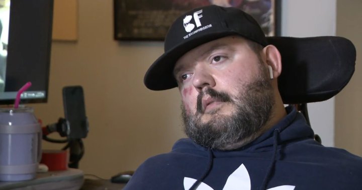 ‘Me sentí como si estuviera en una pelea de MMA’: un hombre discapacitado en Columbia Británica comparte su desgarradora experiencia Air Canada – B.C.