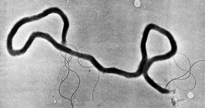 Health officials urge more syphilis testing as U.S. newborn cases skyrocket
