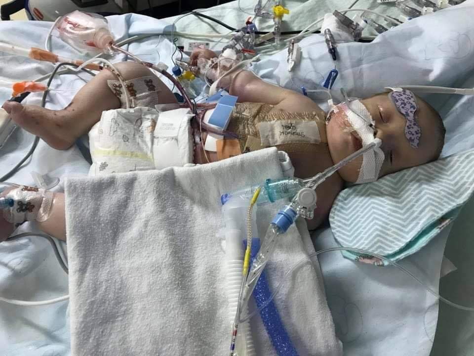 Jaxon after his heart transplant at four months old