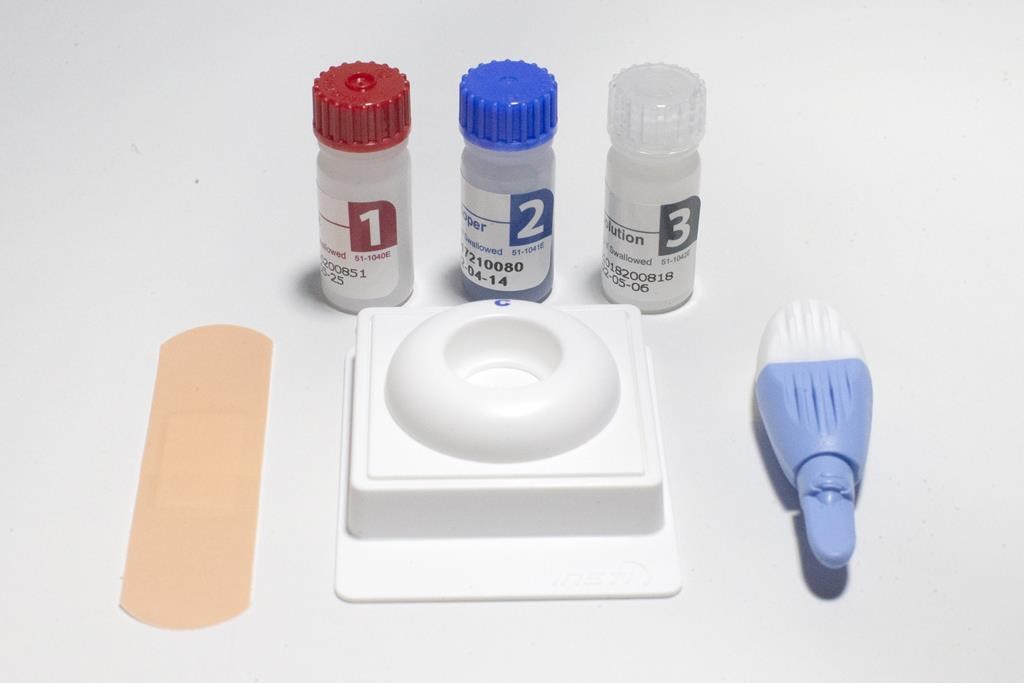 The Test@Home HIV self-test kit is pictured in Toronto on Friday April 16, 2021. Montreal's regional public health authority reports the area recorded its highest number of new HIV diagnoses in 10 years in 2022. 