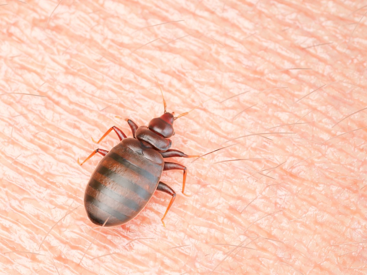 An illustration of a bedbug on human skin.
