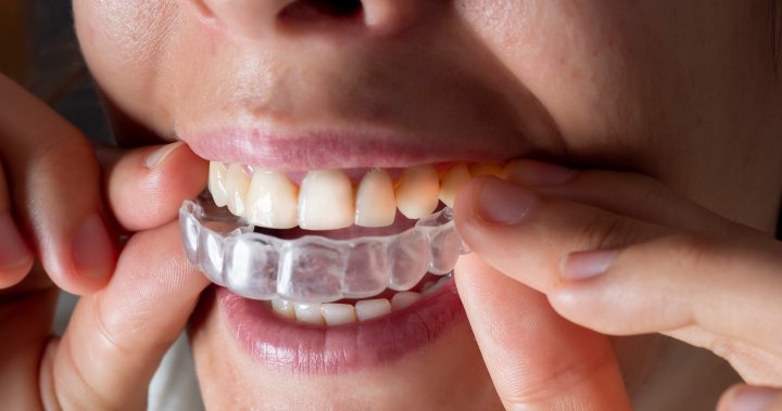 Клиентите на SmileDirectClub доставчикът на ортодонтия за телездраве на устройства