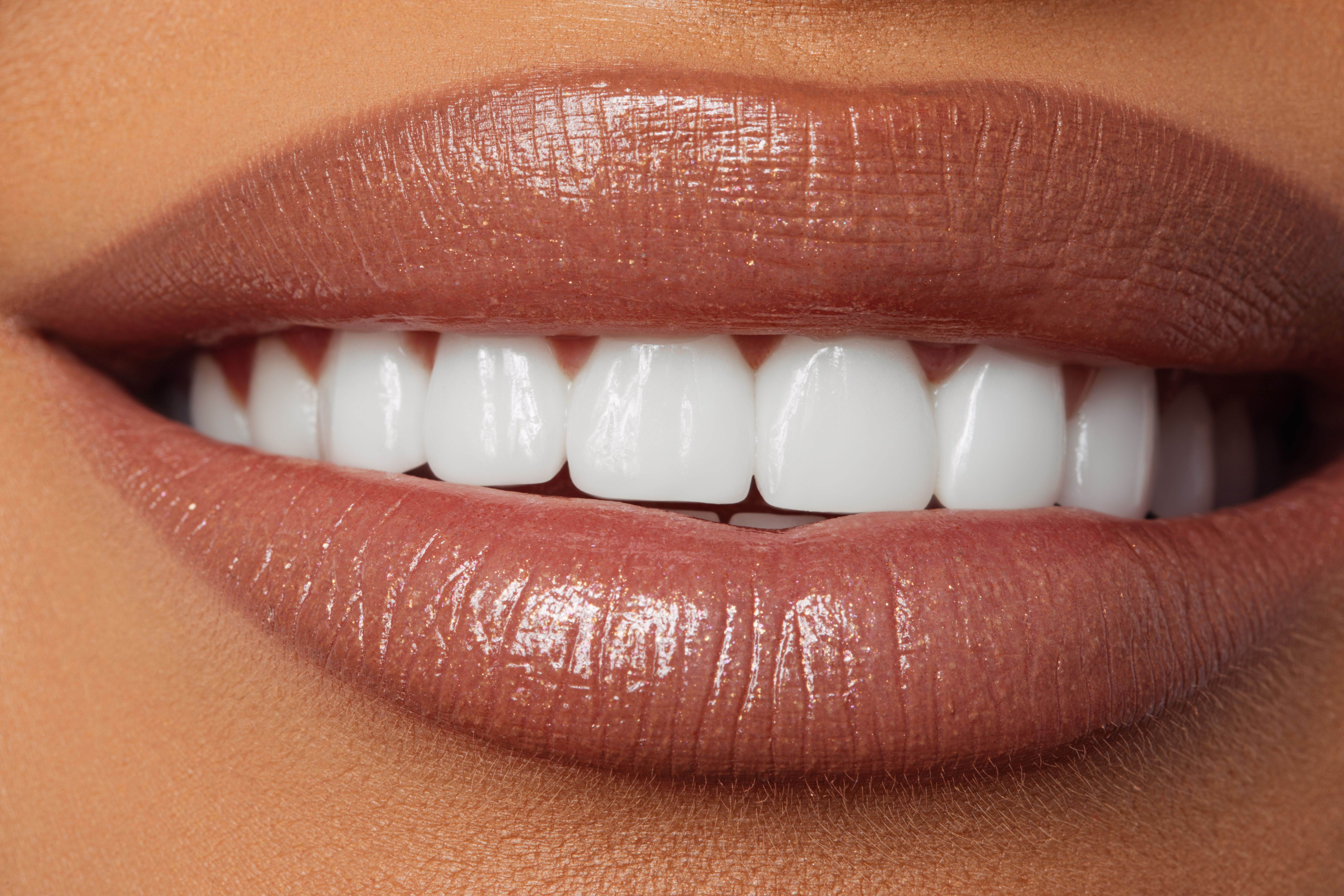 Brighten your smile Best teeth whitening products for sensitive