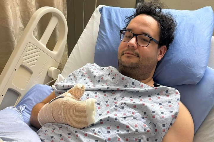 Edmonton man shot in Kingsway Mall crime spree lost finger, faces lengthy recovery