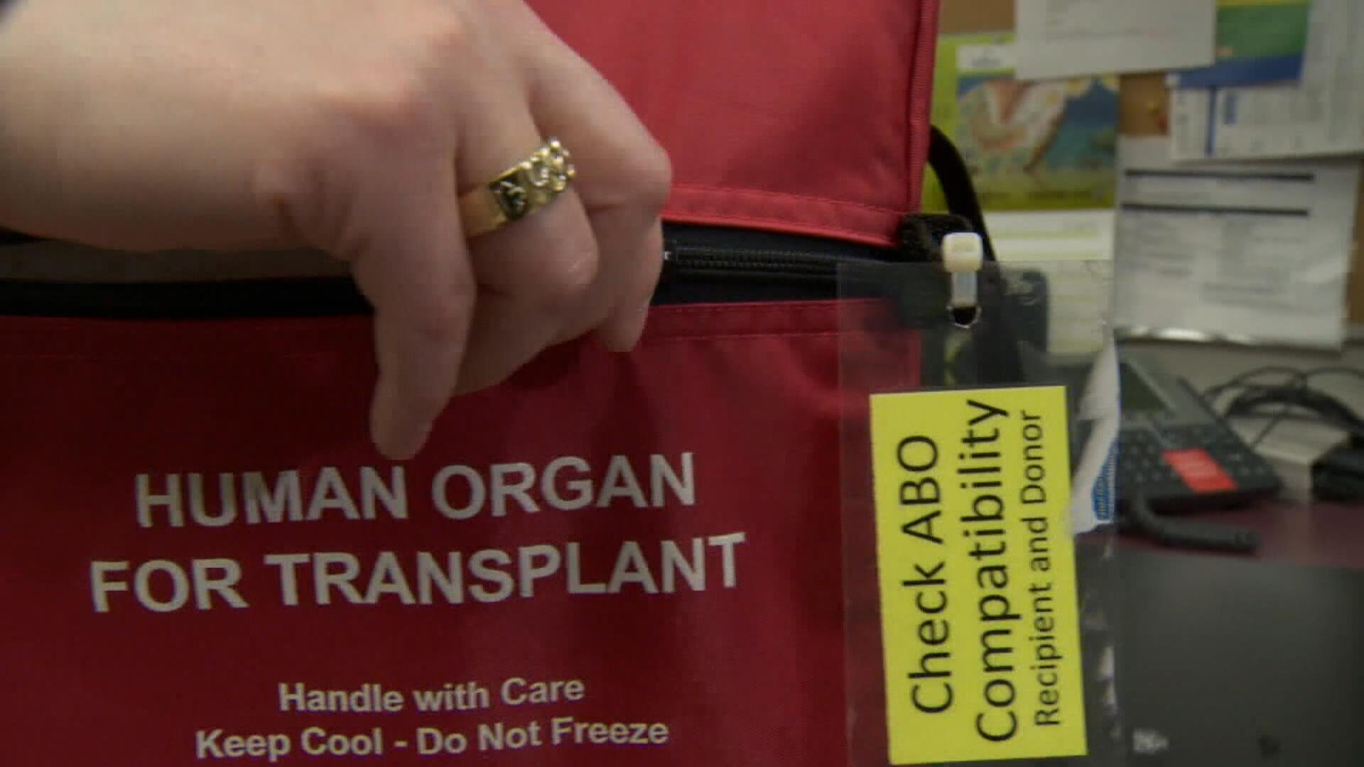 Organ donations and transplants in Canada rebounding to pre-pandemic levels