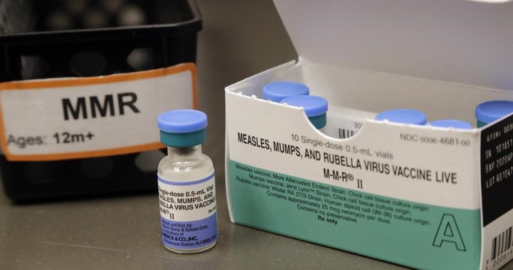 发现一例“感染来源不明”的安大略州麻疹病例