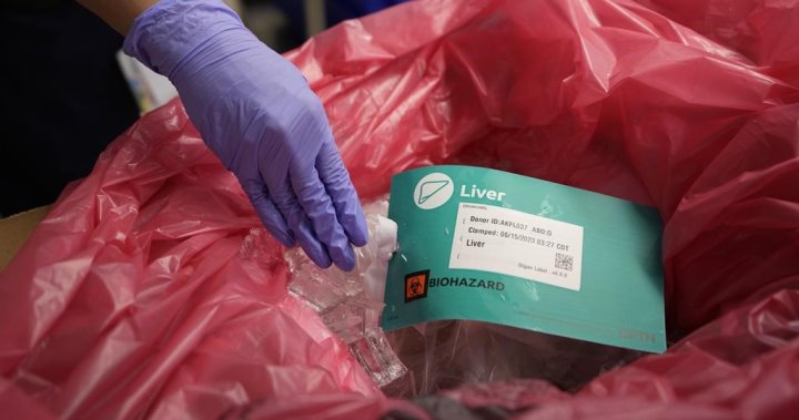 Изследователи от Квебек казват, че даряването на органи изглежда нараства