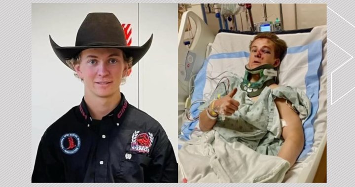 南部亚伯达州的牛仔在车祸中严重受伤：“我没想到他能活下来”