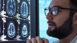 Doctor reading MRI brain scan on screen
