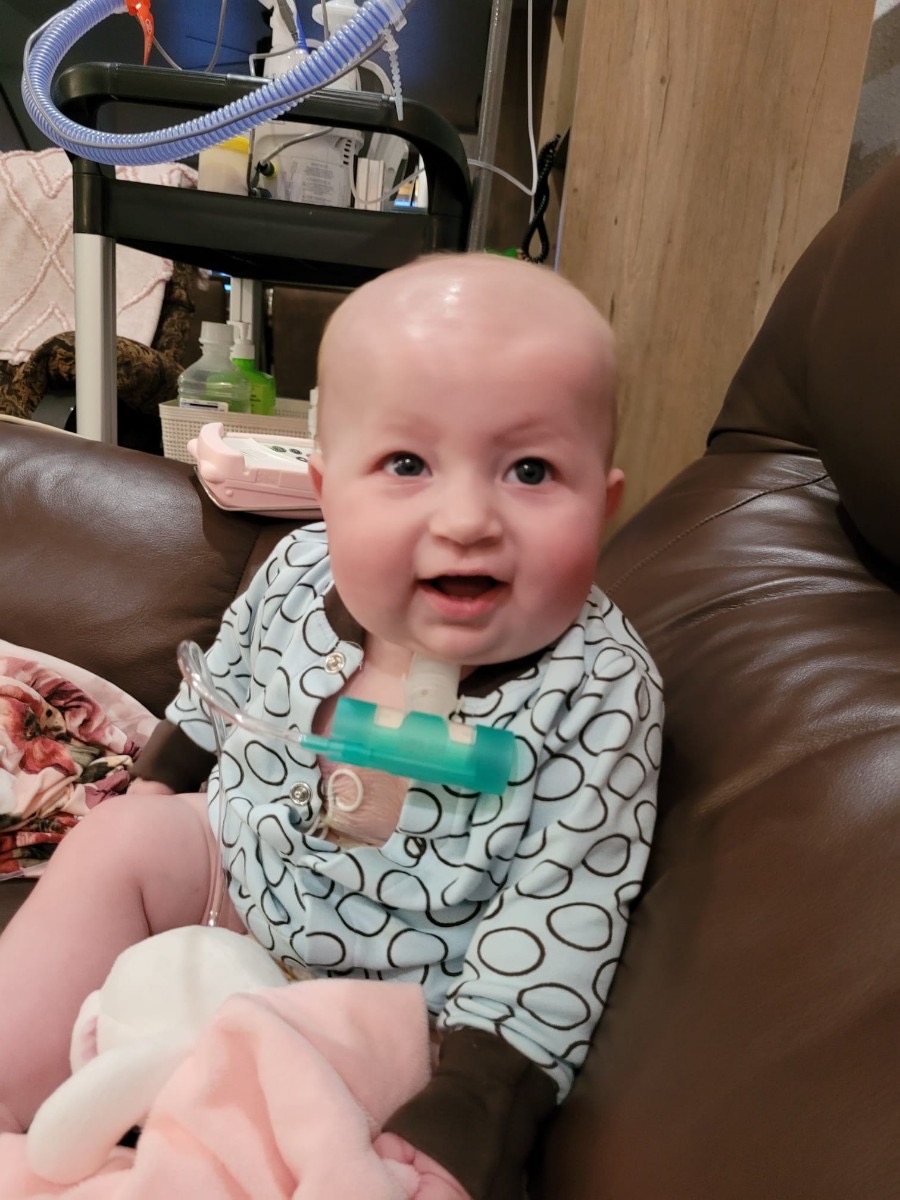 8 month-old baby with a tracheostomy