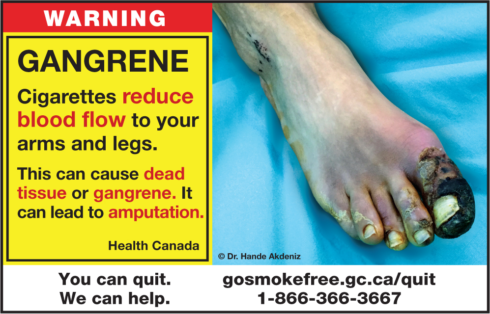 Cigarette packages in Canada are now showing a new set of graphic photos, for the first time since 2012, that link smoking with cancer as well as gangrene and various other diseases.