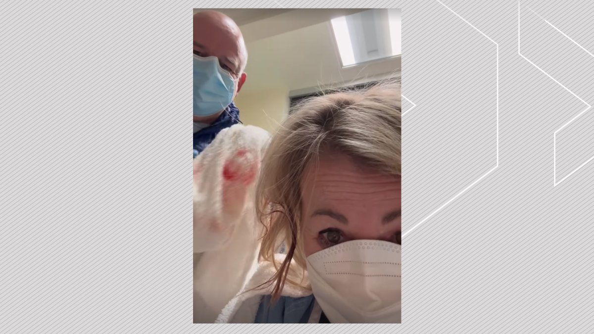 An image from a social media video showing Jann Arden (R) having her head would cleaned up by a man she identified as Nigel, in a social media post on Jan. 11, 2024.