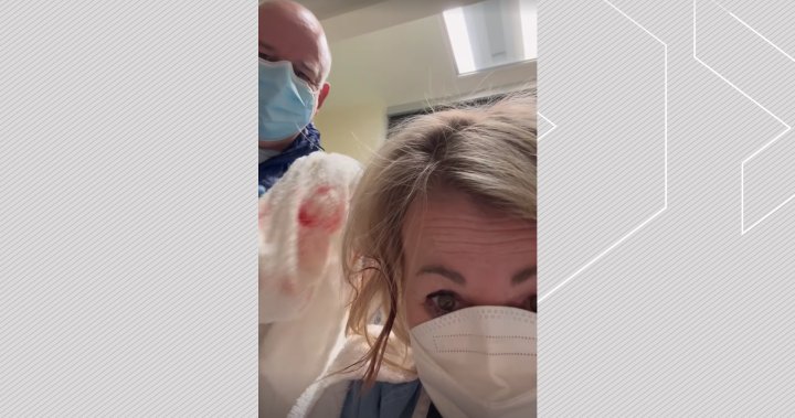 „Най-лошата среща в Tinder някога“: Jann Arden е помолена да почисти собствената си рана на главата в болница