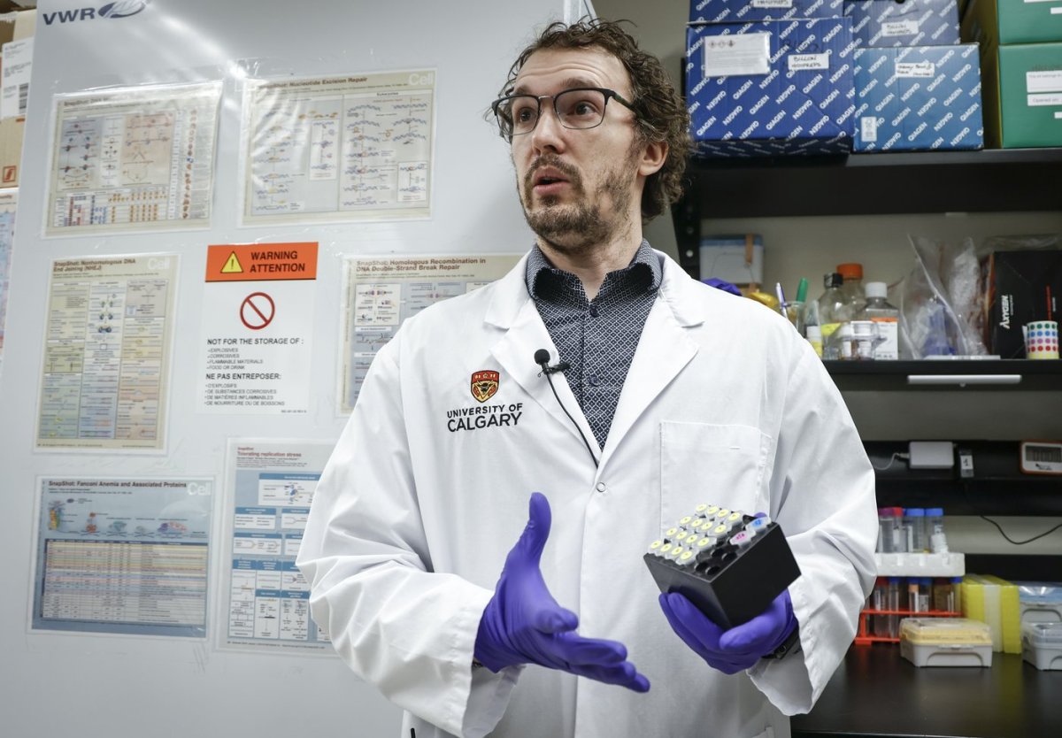 Pierre Billon, an assistant professor of biochemistry and molecular biology at the University of Calgary.