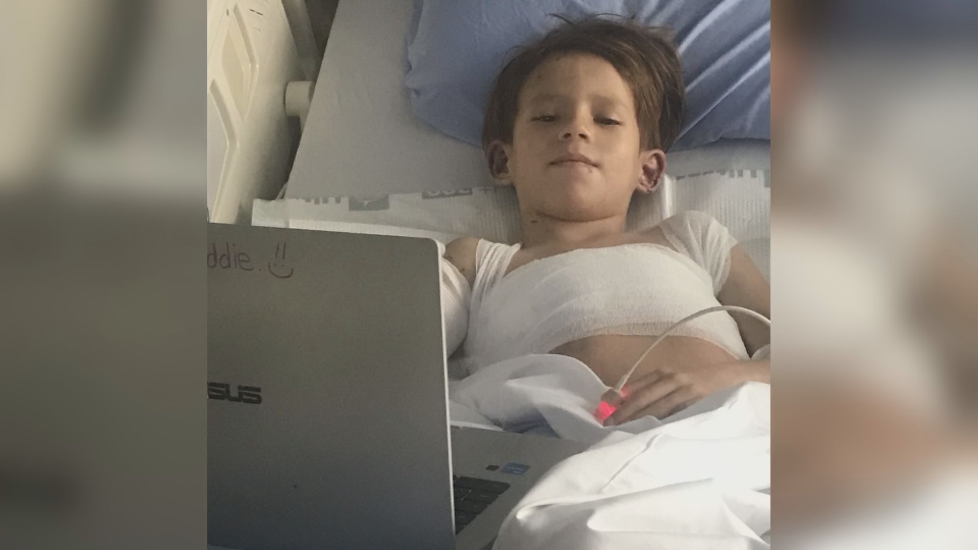 Седемгодишно момче е в болница след жестоко нападение на куче