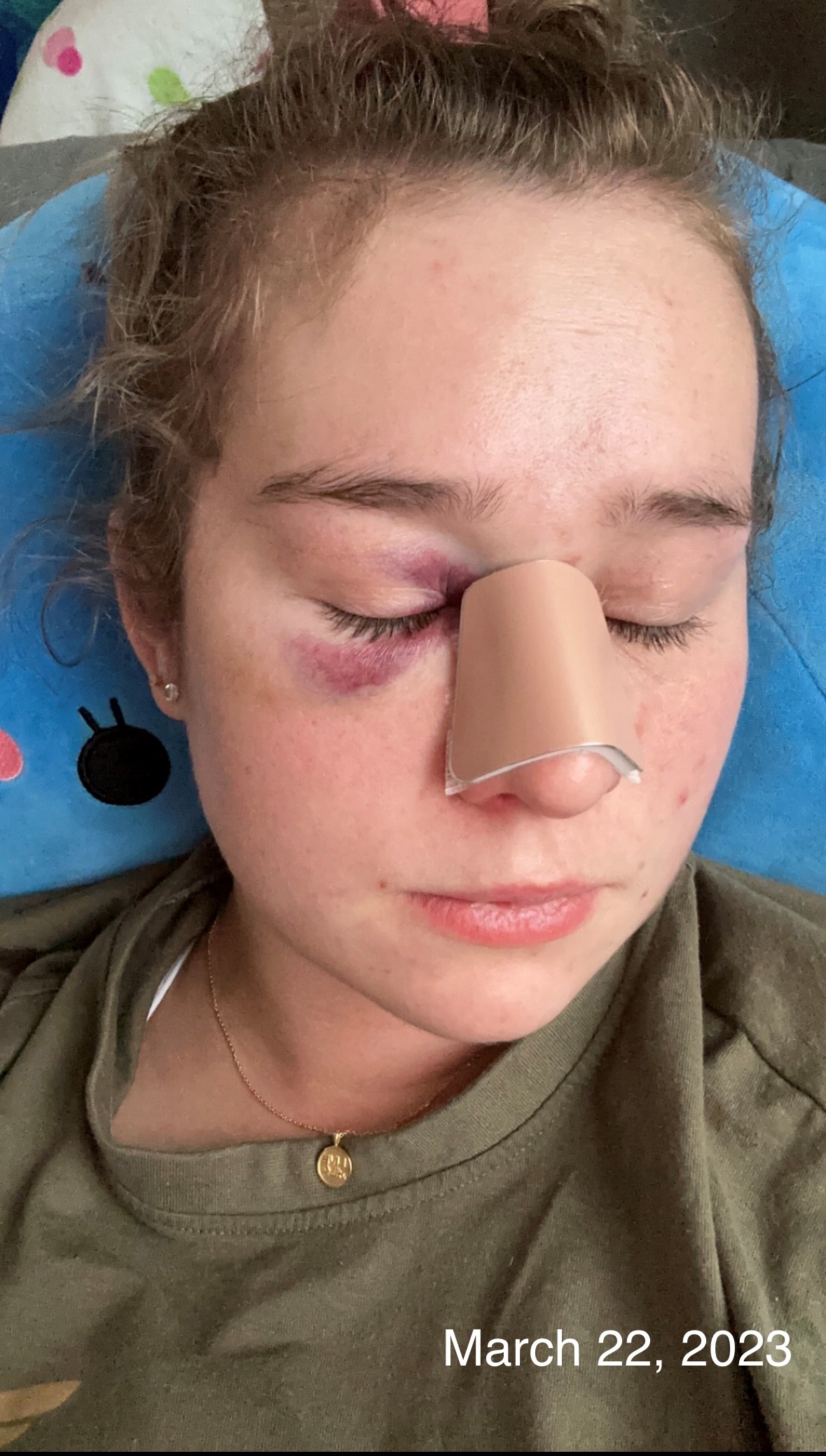 Shelby, a teacher who used to work in Saskatchewan, recalled her experience being attacked by a student, resulting in a concussion and a broken nose.