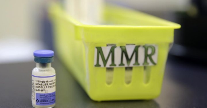 疫情报告：麻疹患者与一所约克地区高中存在“密切接触”：公共卫生部门